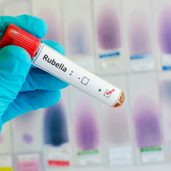 Rubella In Pregnancy  (German Measles)